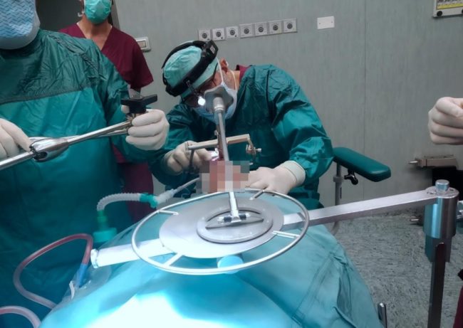 Il primo intervento di chirurgia ultrasonica a Portogruaro