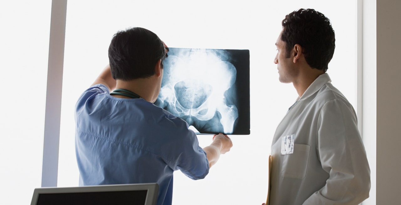 Fragilità ossea: tra gli over 50, 1 donna su 3 è a rischio frattura